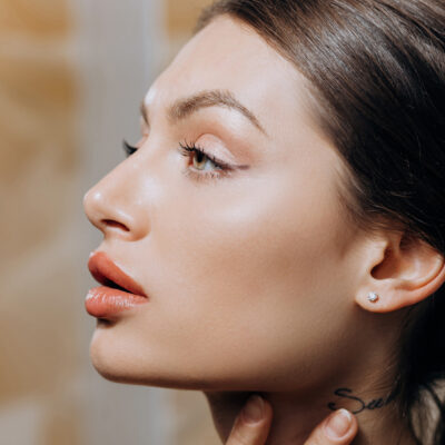 Dysport® 50 Units (Softer than Botox® look)