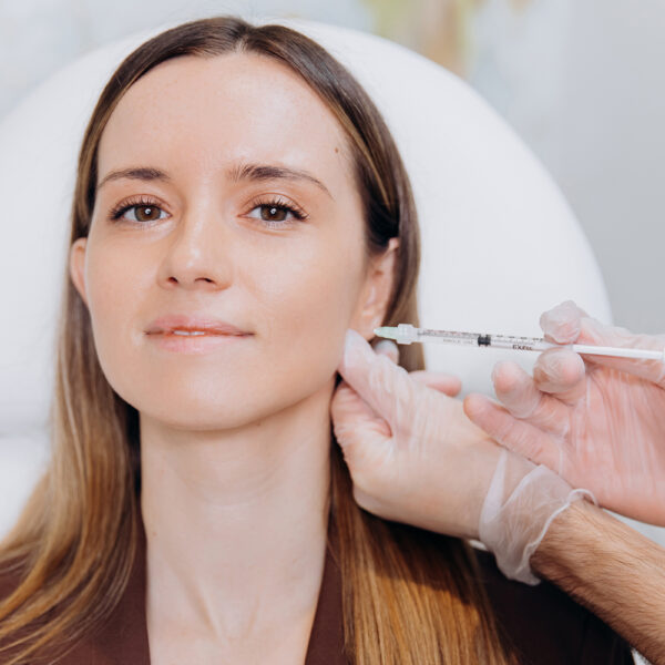 JUVEDERM VOLUMA® Cheeks Dermal Filler