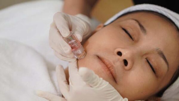 Rejuvenation Combo: with Belotero Balance Filler and 30 units of BOTOX