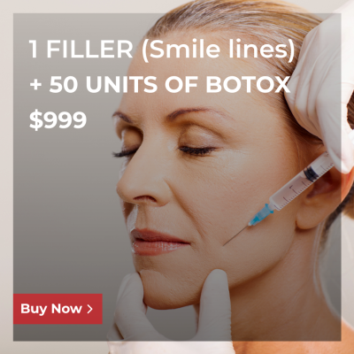1 FILLER (Smile lines) + 50 Units of BOTOX