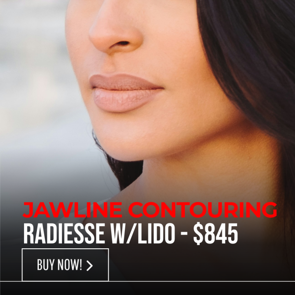 JAWLINE CONTOURING - RADIESSE w/LIDO