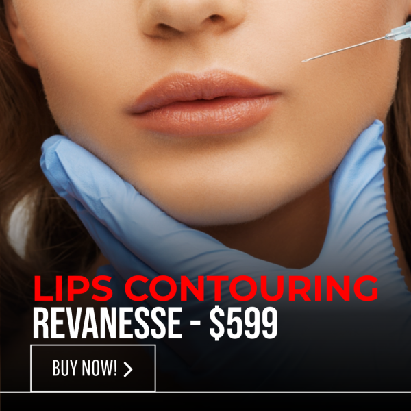 LIPS CONTOURING - REVANESSE