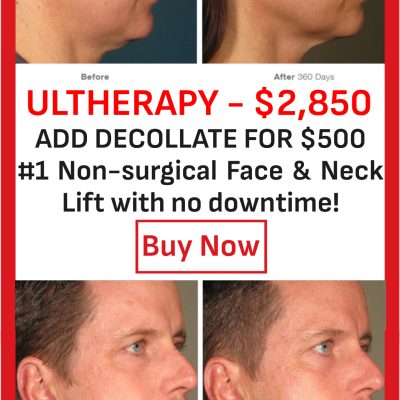 ULTHERAPYULTHERAPY and add Decollate