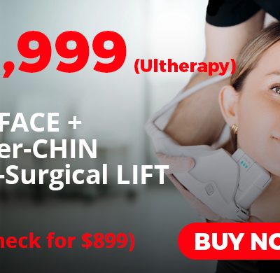 ULTHERAPY Full FACE + under-CHIN non-surgical LIFT