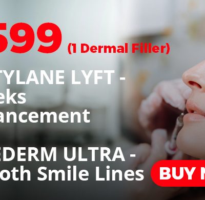 1 Dermal Filler - RESTYLANE LYFT - Cheeks Enhancement or JUVEDERM ULTRA - Smooth Smile Lines